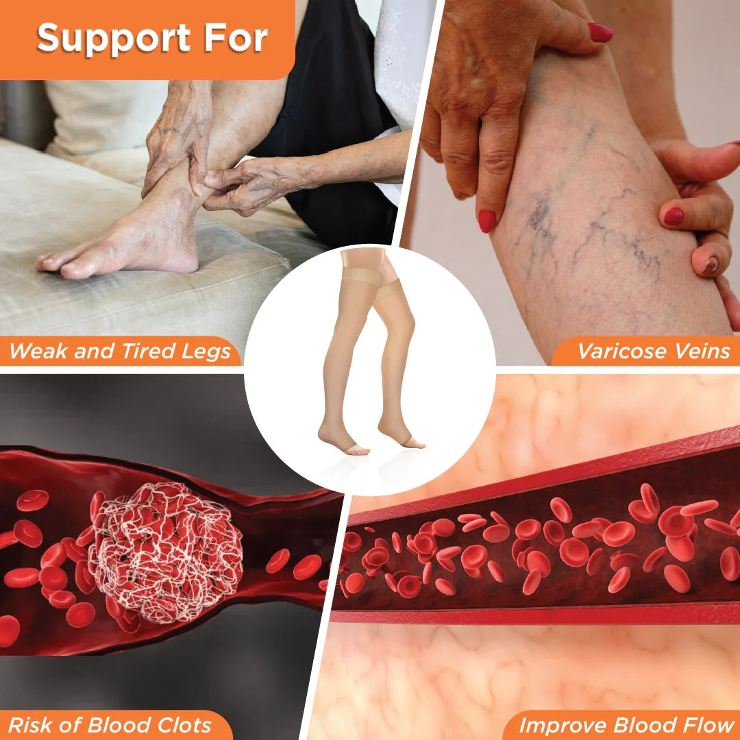 Vissco Medical Compression Thigh Length | Mild Support